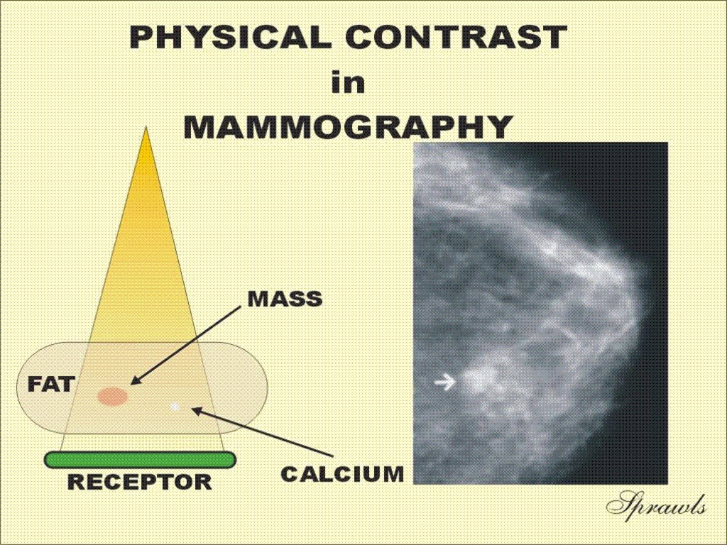 Mammography Physics